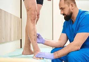 Spider Veins Service