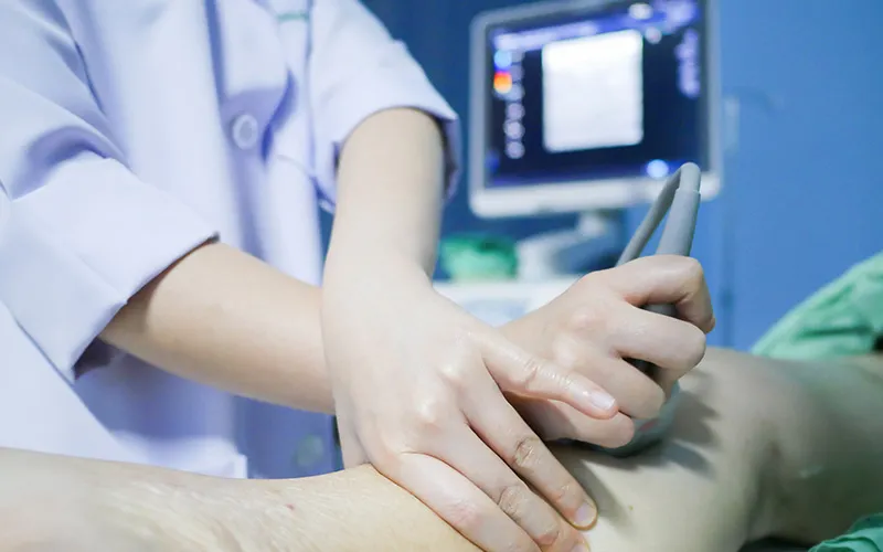 Venous Ultrasound