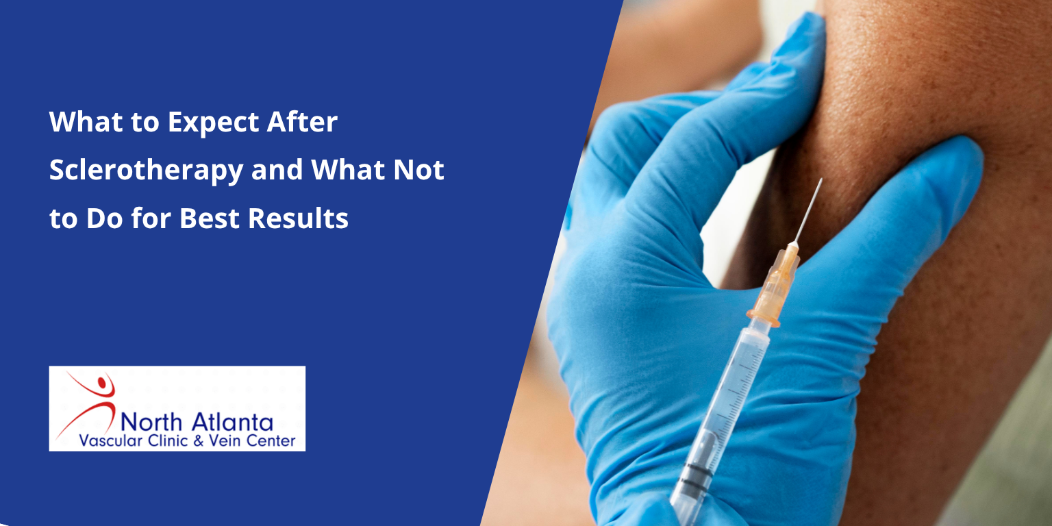 What to Expect After Sclerotherapy and What Not to Do for Best Results