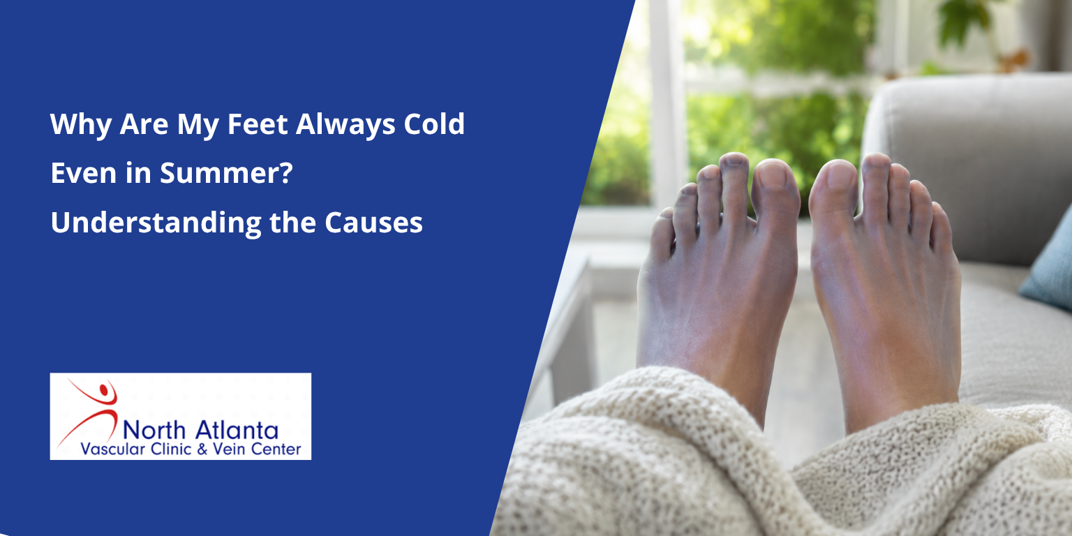 Why Are My Feet Always Cold Even in Summer? Understanding the Causes