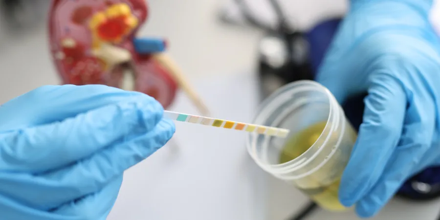 Urologist performing a urine analysis test