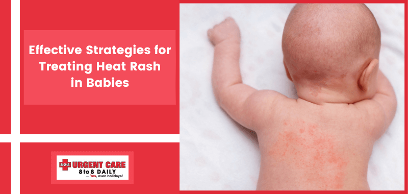 Heat Rash On Baby - Causes And Treatment