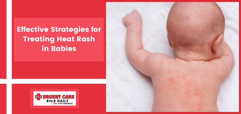 Pfb Rash Mild Heat Rash On Stomach