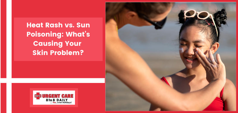 Heat Rash vs. Sun Poisoning: What’s Causing Your Skin Problem?