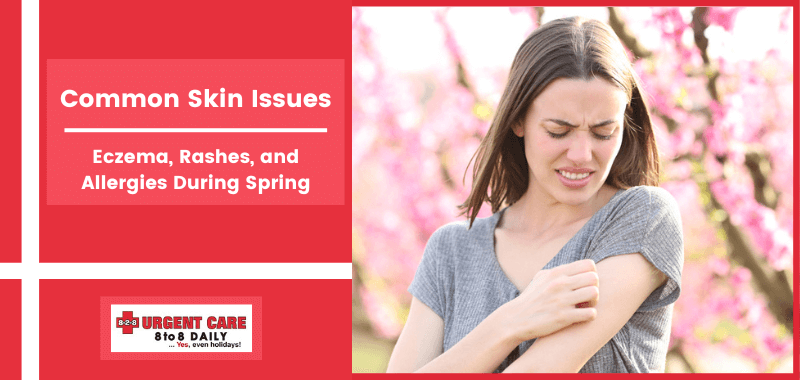 Common Skin Issues: Eczema, Rashes, and Allergies During Spring