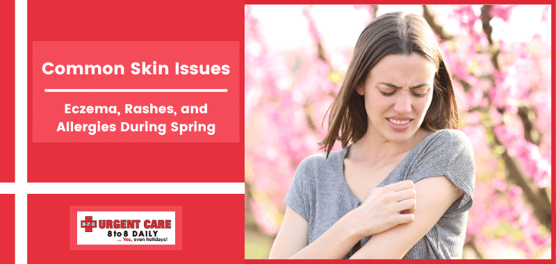 Common Skin Issues: Eczema, Rashes, and Allergies During Spring | 8-2-8 ...