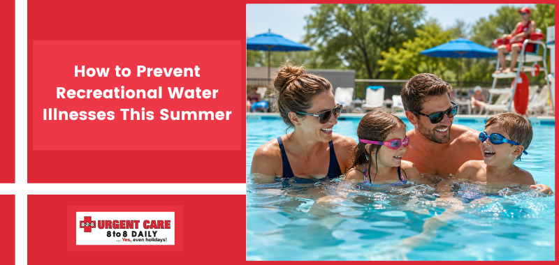 How to Prevent Recreational Water Illnesses This Summer