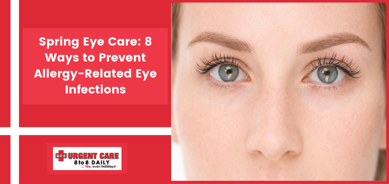Spring Eye Care: 8 Ways to Prevent Allergy-Related Eye Infections