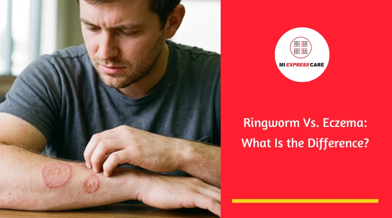Ringworm Vs. Eczema: What Is the Difference?