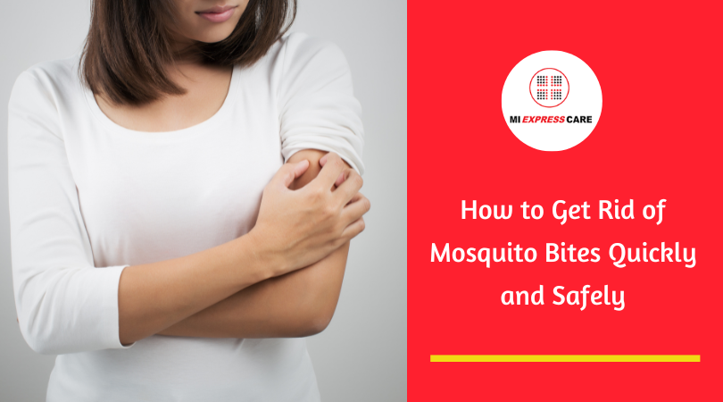 How to Get Rid of Mosquito Bites Quickly and Safely