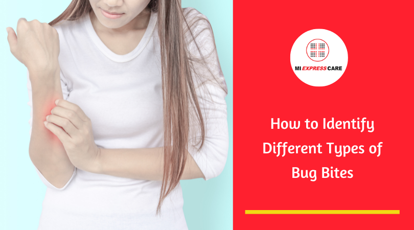 How to Identify Different Types of Bug Bites