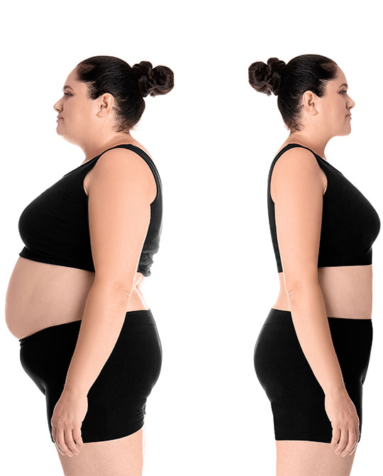 Benefits of Choosing Medically Supervised Weight Loss