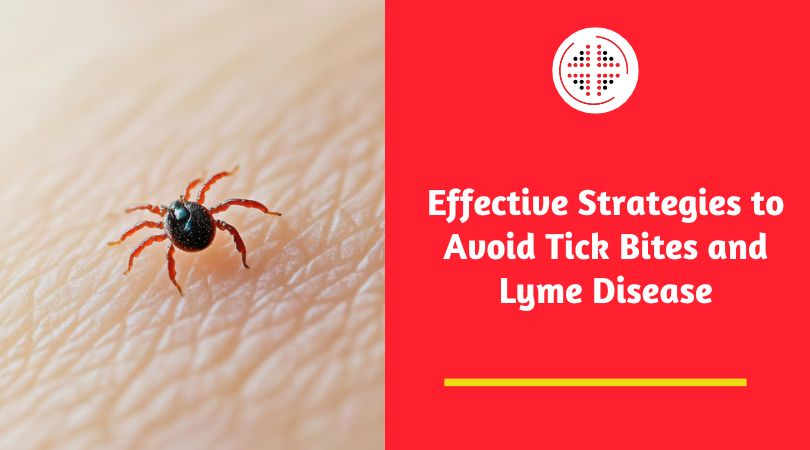 Effective Strategies to Avoid Tick Bites and Lyme Disease