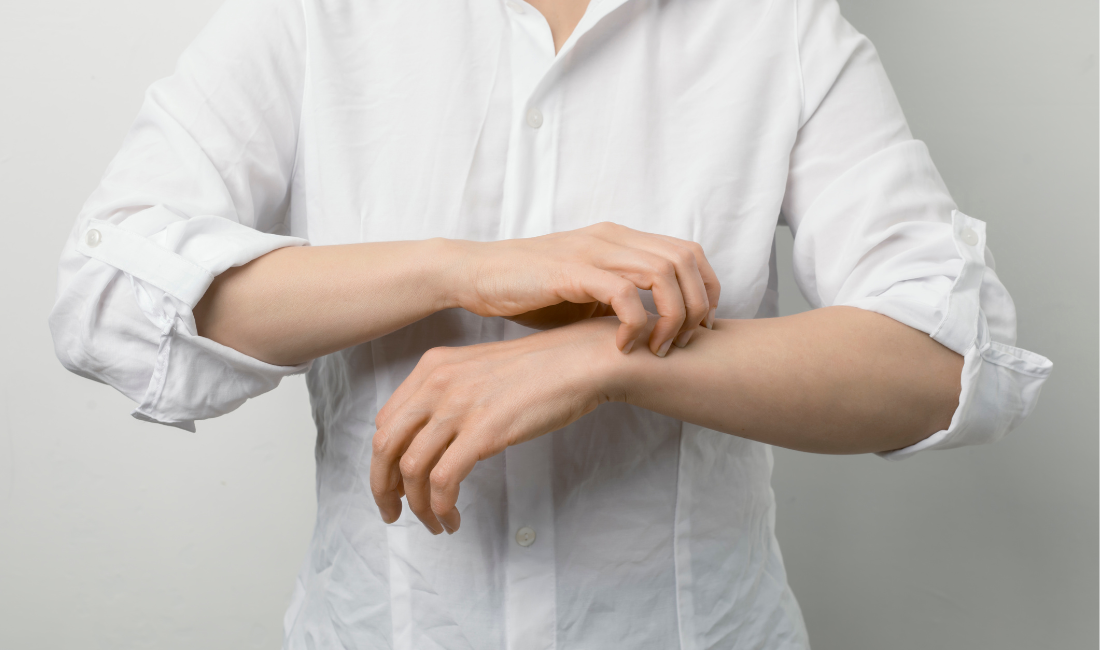 What Is Scabies?