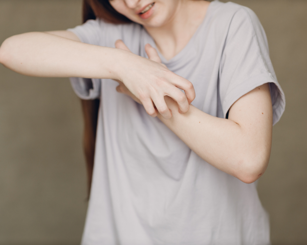 Signs and Symptoms of Scabies