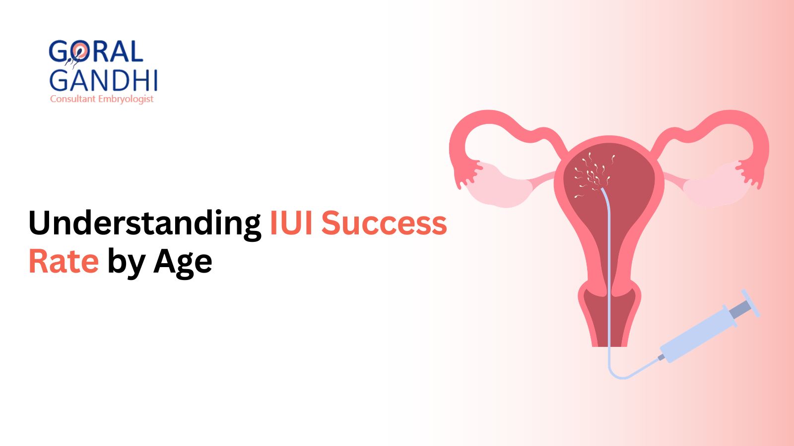 IUI Success Rate by Age: What to Expect in Your 20s, 30s, and 40s