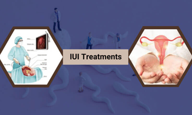 Expert IUI Treatment at Mumbai’s Top Fertility Center,