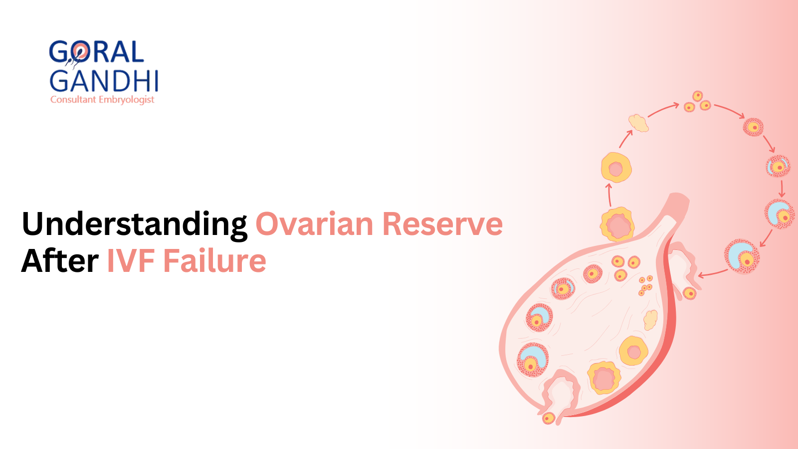 Ovarian Reserve Testing for Better IVF Outcomes After Failure