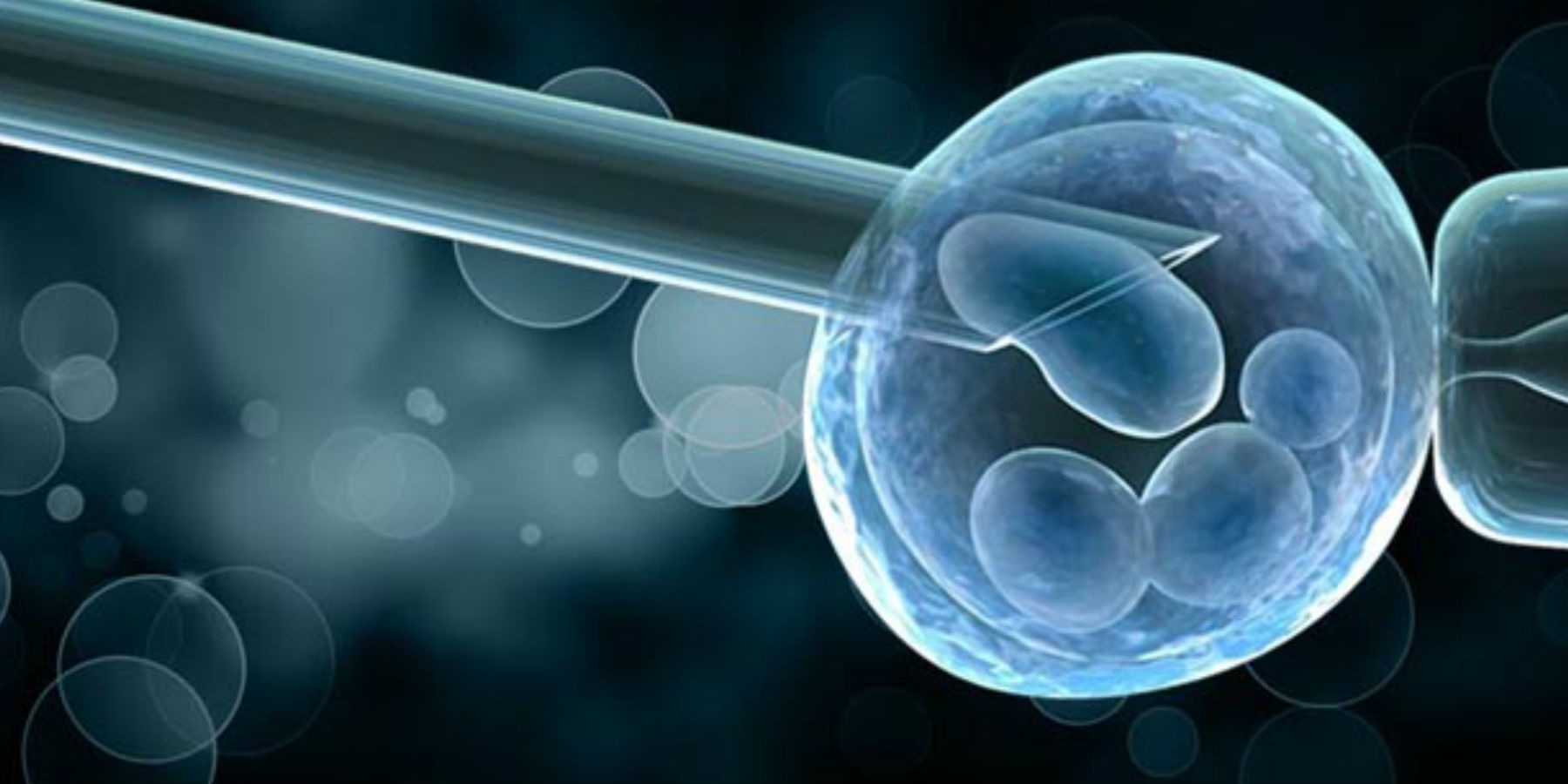 Pre-Implantation Genetic Diagnosis: An Overview