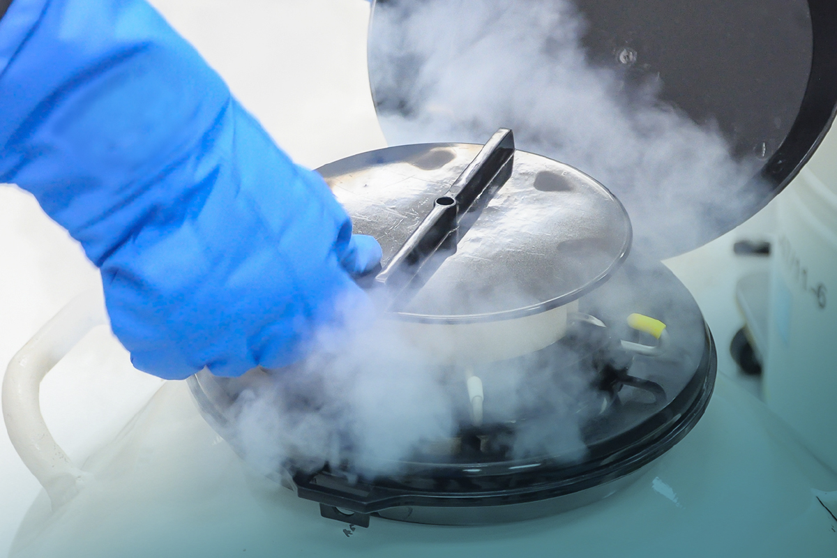 Egg Freezing Procedure in India and Who Needs It Mostly