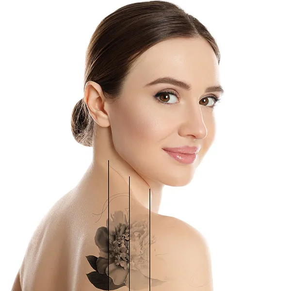 Tailored Tattoo Removal Solutions at Aria Medspa