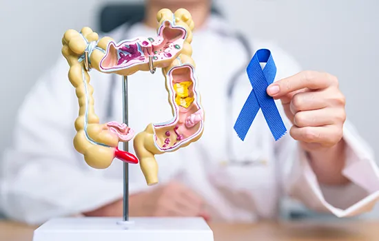 Colorectal Cancer