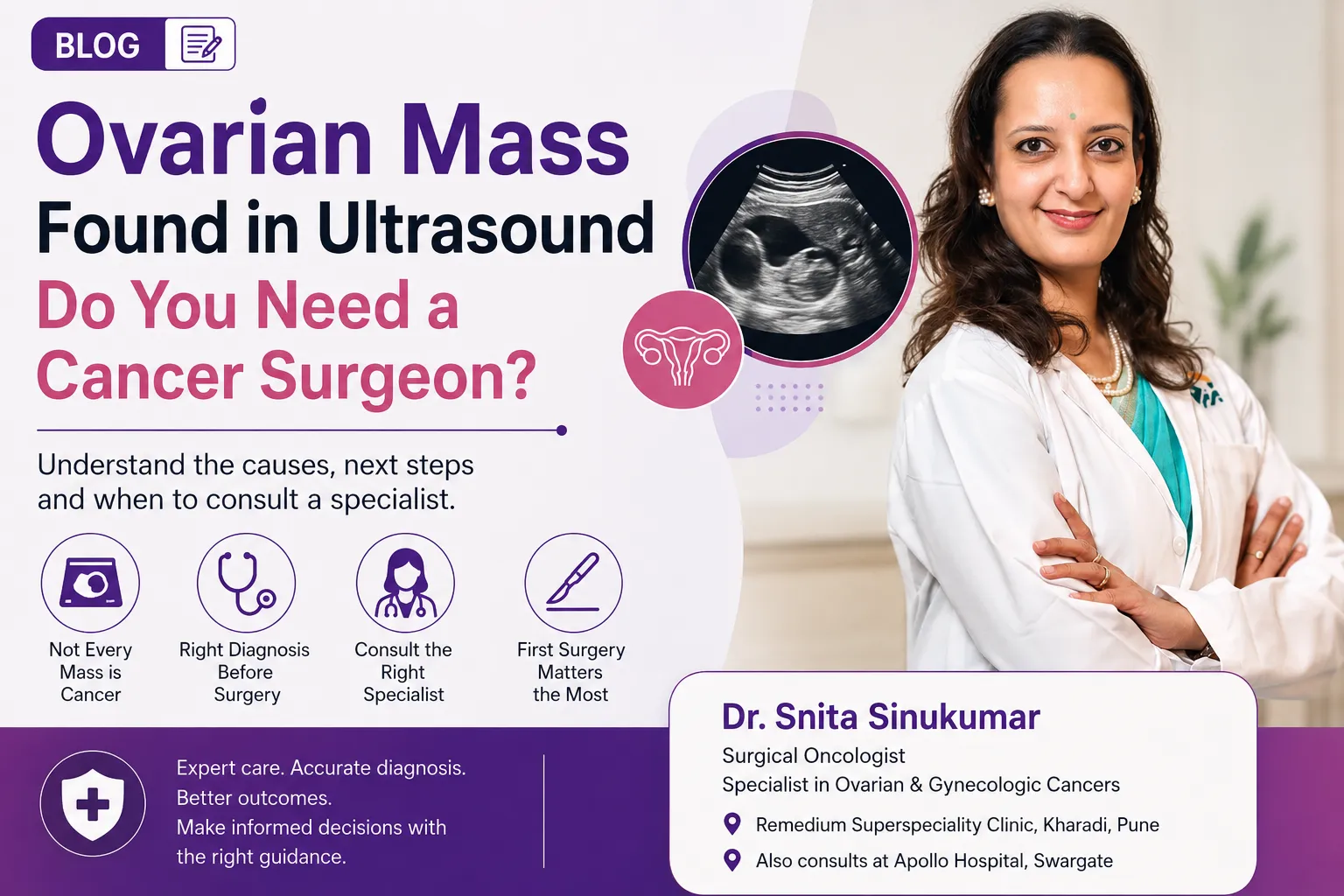 Ovarian Mass Found in Ultrasound Do You Need a Cancer Surgeon