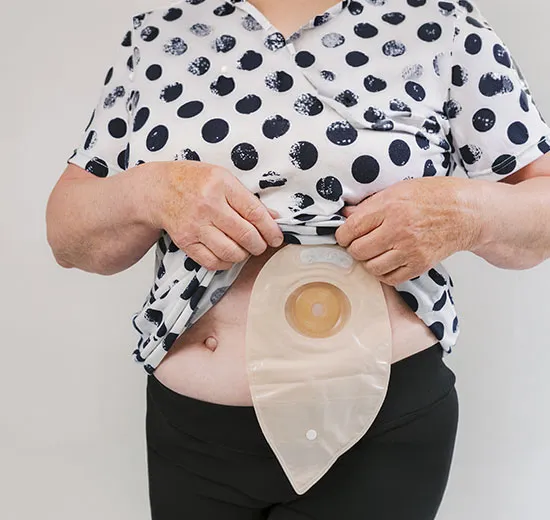 Why Choose Our Stoma Care Program in Pune?