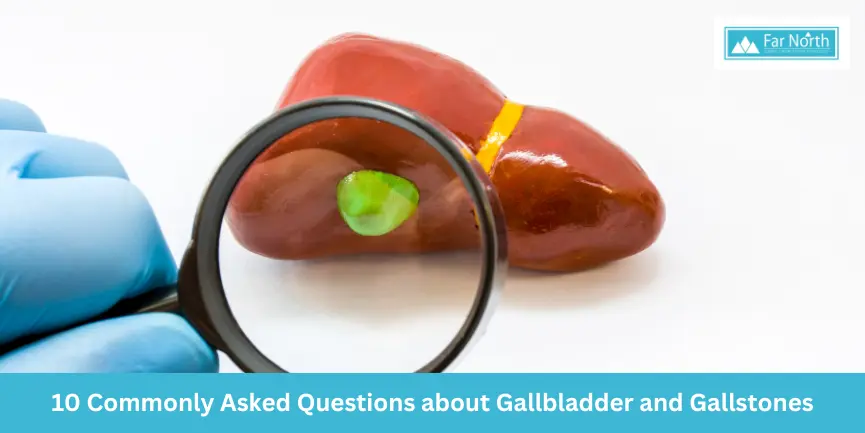 10 Commonly Asked Questions about Gallbladder and Gallstones