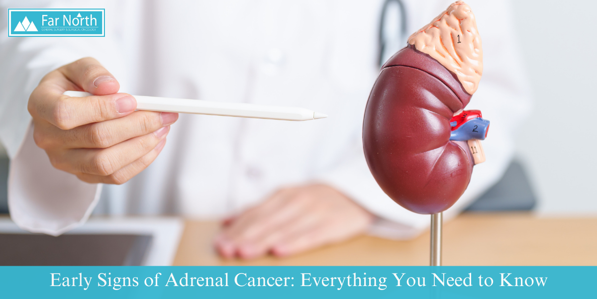 Early Signs of Adrenal Cancer: Everything You Need to Know