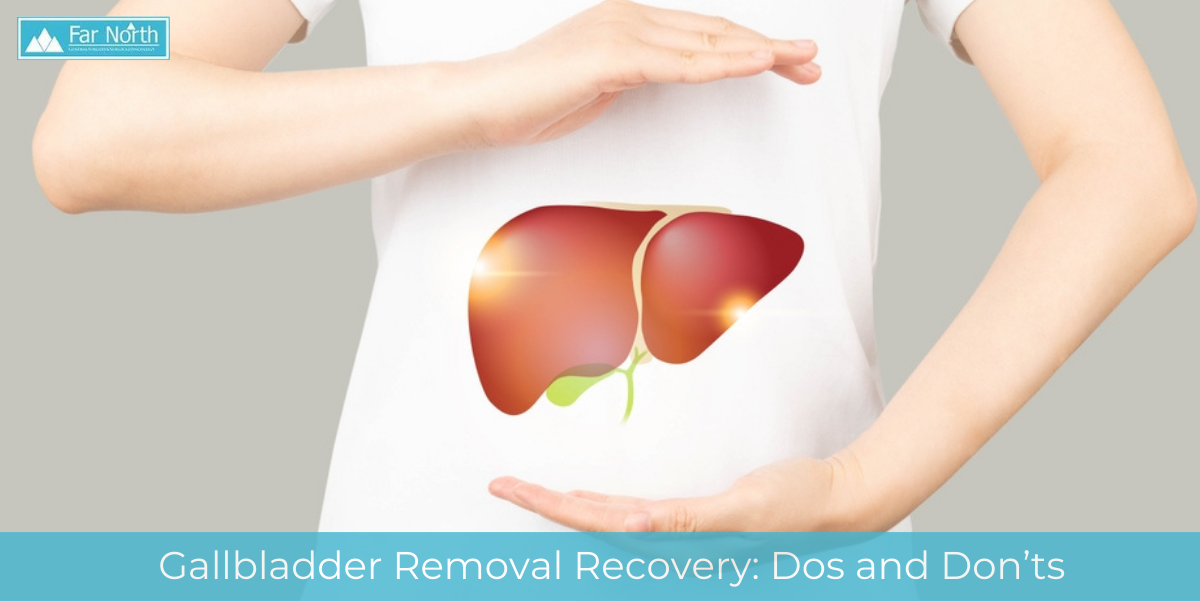 Gallbladder Removal Recovery: Dos and Don’ts