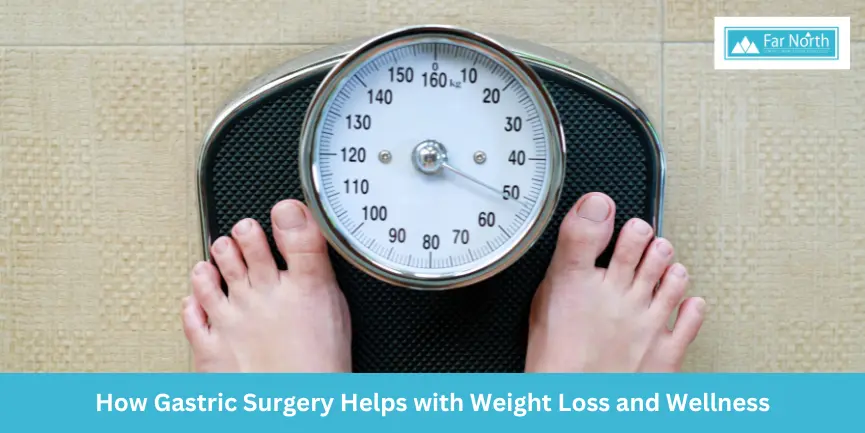 How Gastric Surgery Helps with Weight Loss and Wellness