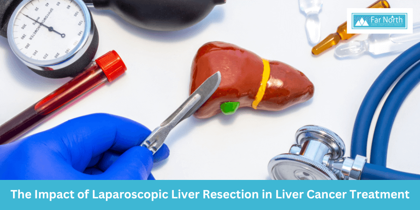 impact-of-laparoscopic-liver-resection