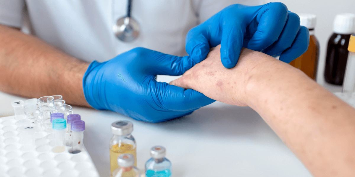Melanoma Treatment: Everything You Should Know