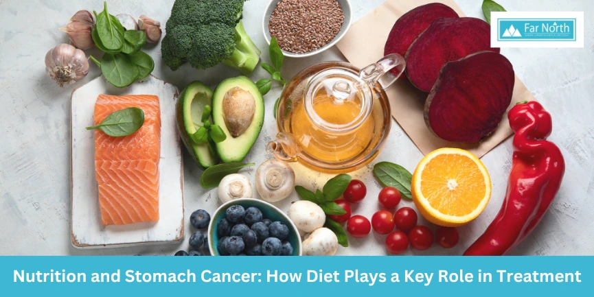 Nutrition and Stomach Cancer: How Diet Plays a Key Role in Treatment