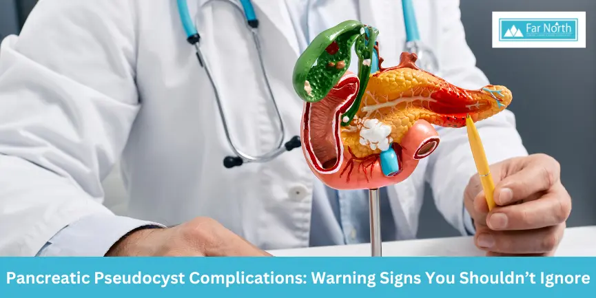 pancreatic-pseudocyst-complications-warning-signs-you-should-not-ignore