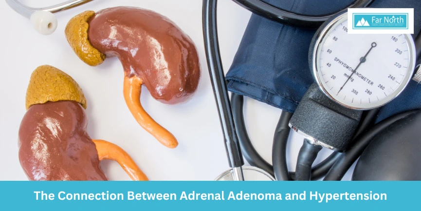 the-connection-between-adrenal-adenoma-and-hypertension