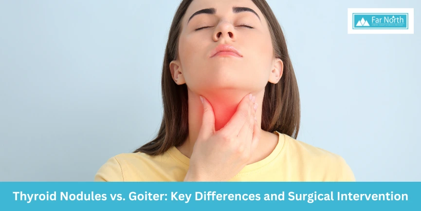 Thyroid Nodules vs Goiter: Differences and the Role of Surgery in Treatment