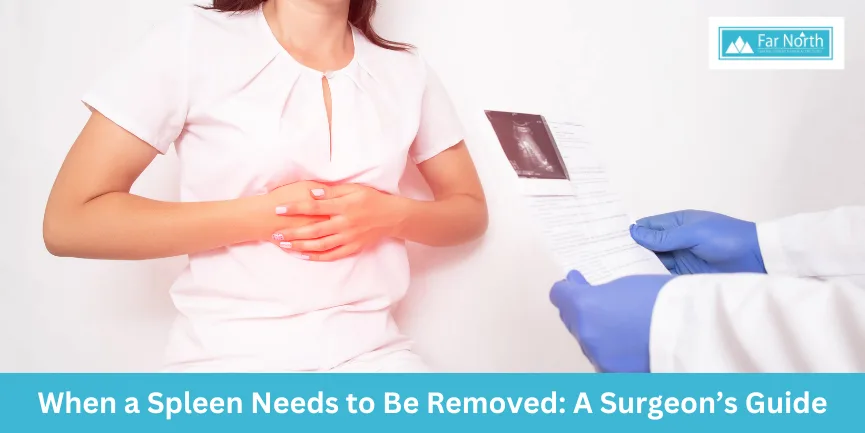 When a Spleen Needs to Be Removed: A Surgeon’s Guide