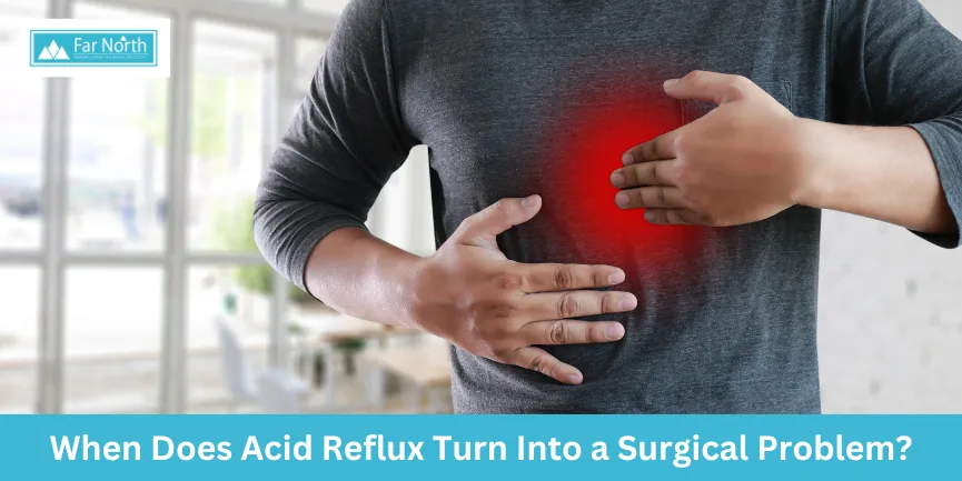 When Does Acid Reflux Turn Into a Surgical Problem?
