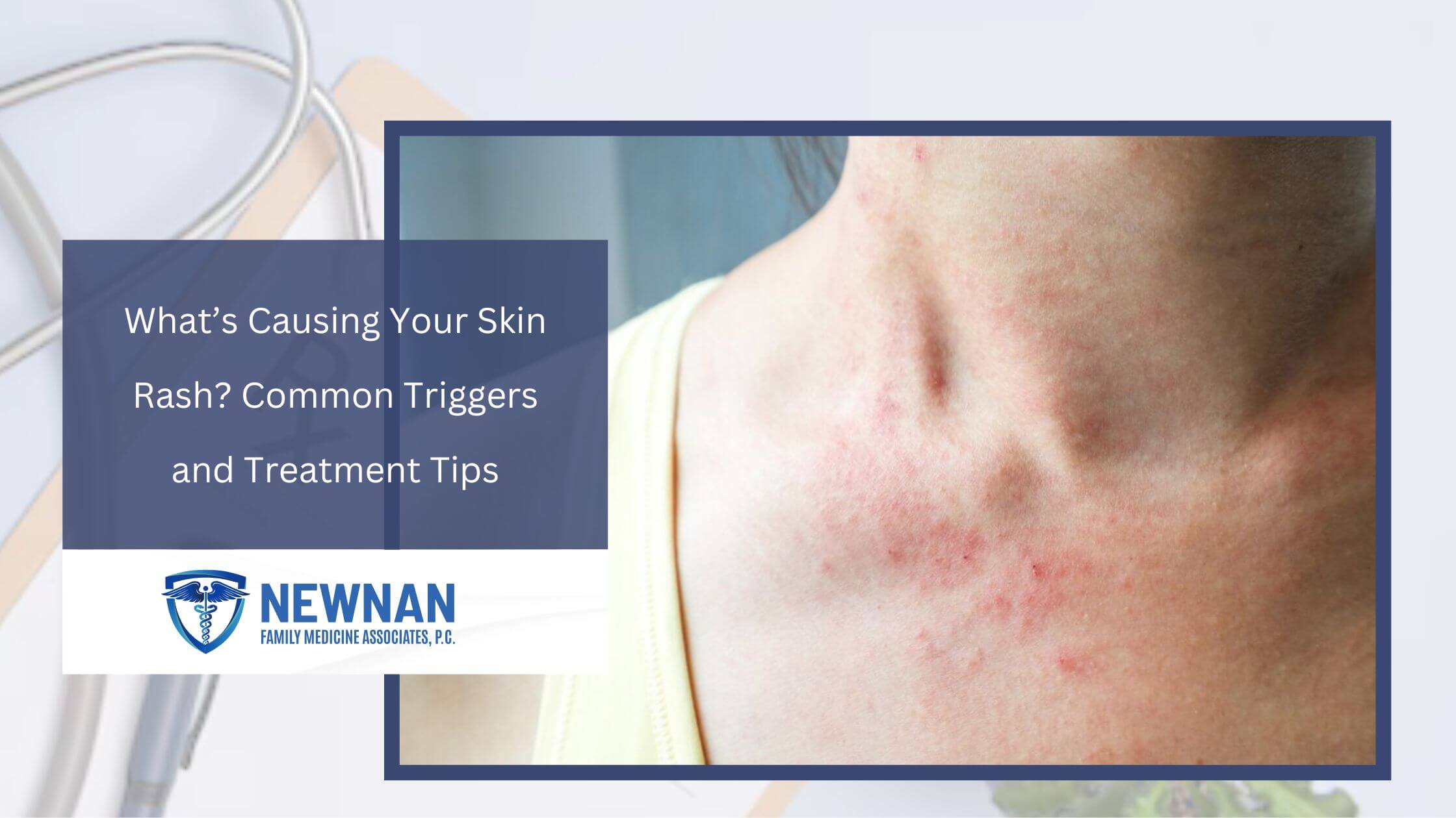 what causes skin rash