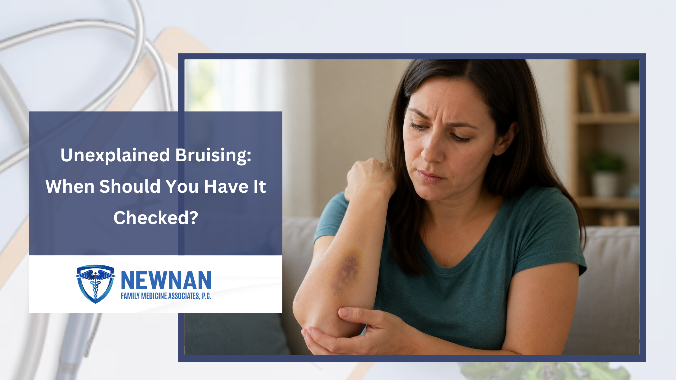 Unexplained Bruising: When Should You Have It Checked? 