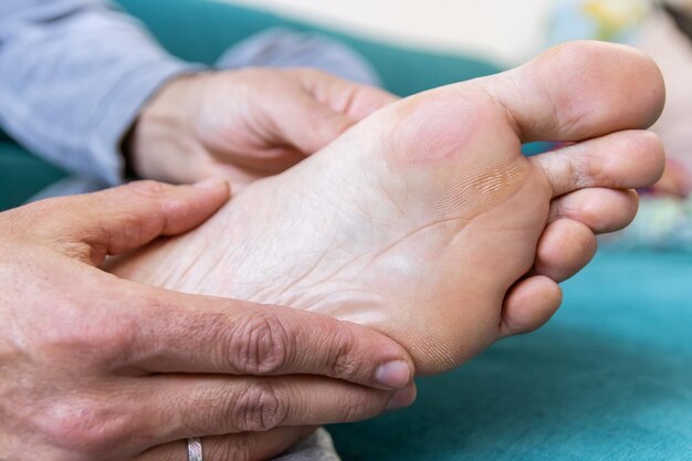 Diabetic peripheral neuropathy