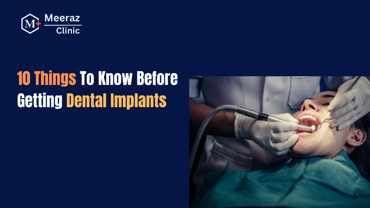 10 Things To Know Before Getting Dental Implants
