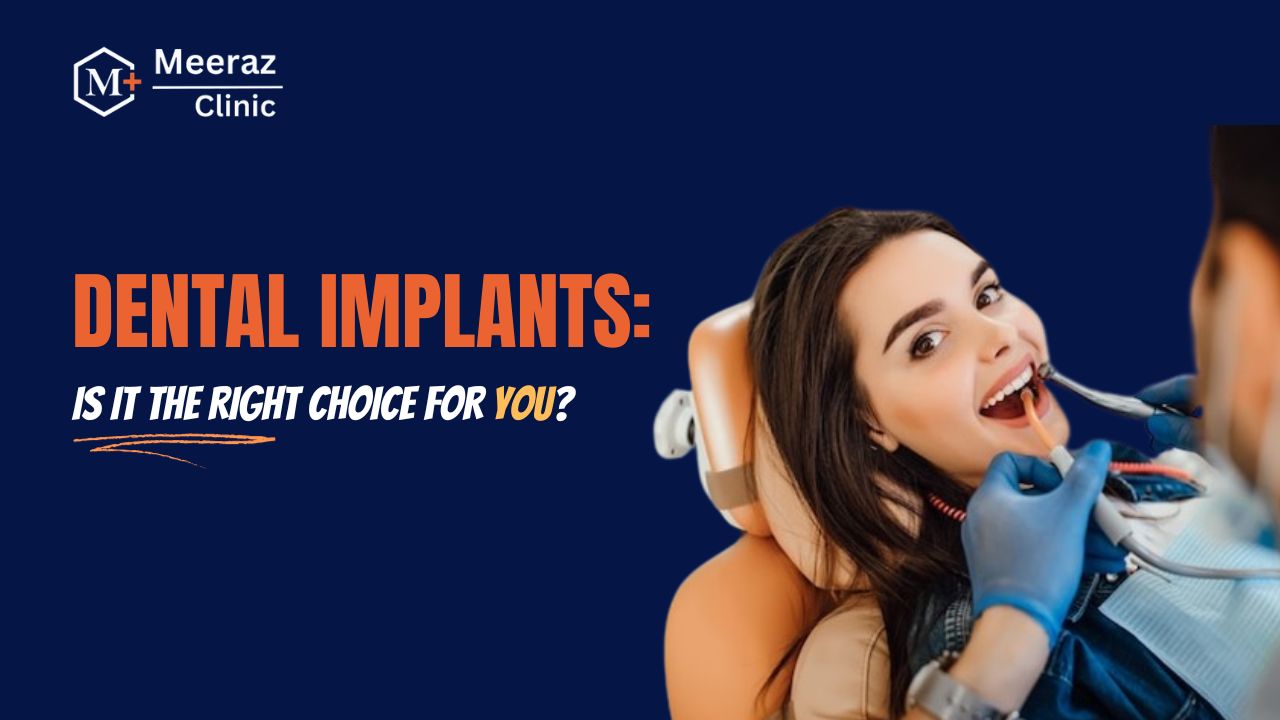 Dental Implants Is It the Right Choice for You