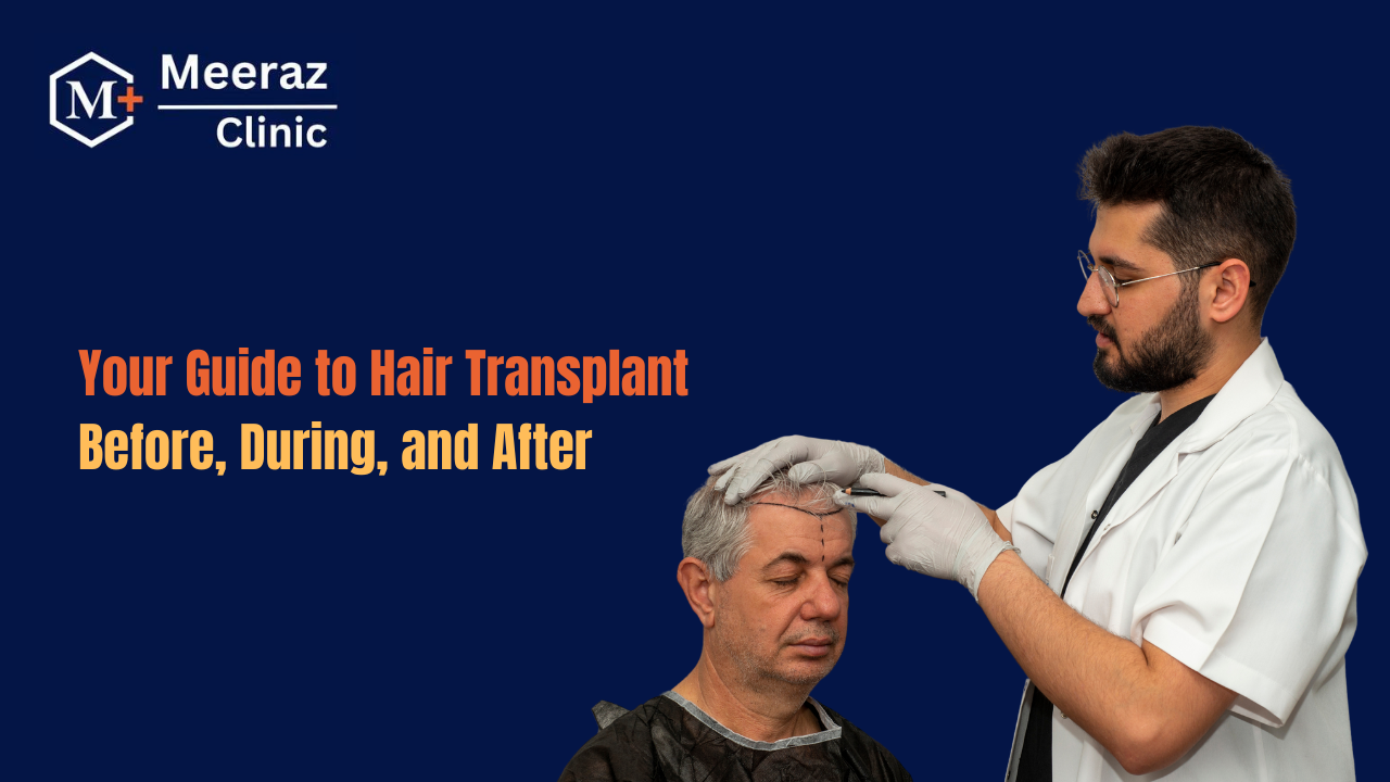 Everything You Need to Know Before, During, and After Your Hair Transplant