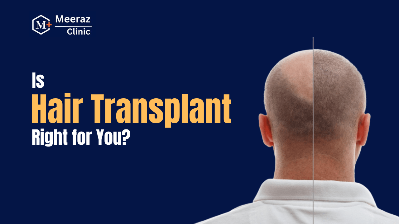 a bald person with hair transplant treatment done at meeraz clinic mumbai in a blog banner image