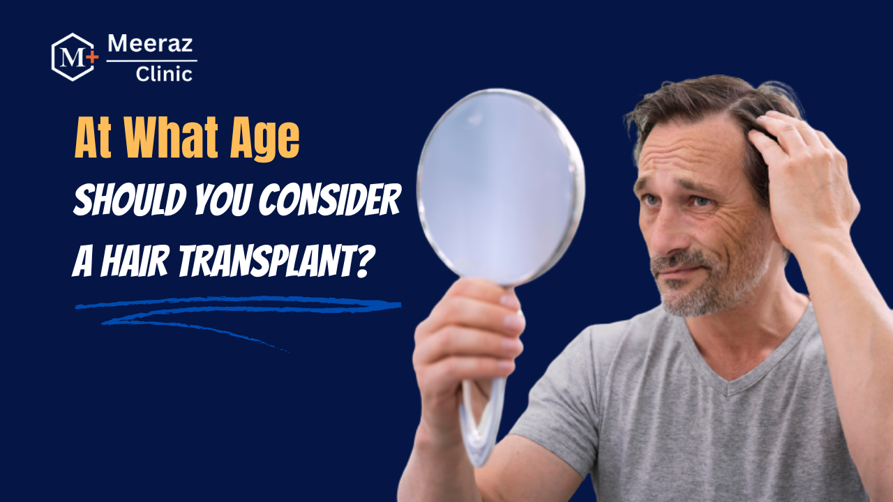 At What Age Should You Consider a Hair Transplant?