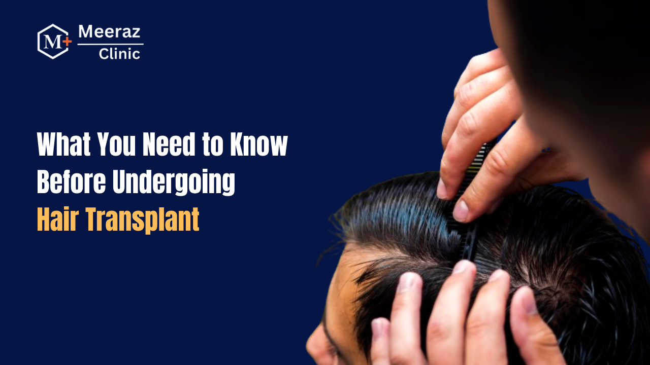 What You Need to Know Before Undergoing Hair Transplant