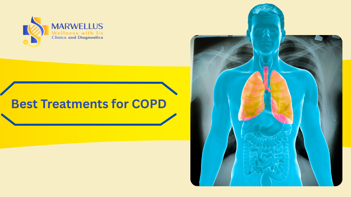 What are the Best Treatments for COPD?
